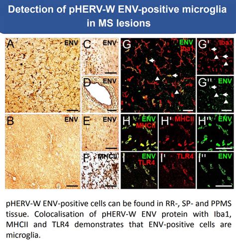 The human endogenous retrovirus type W (pHERV-W) was found to be a major contributor to nerve ...