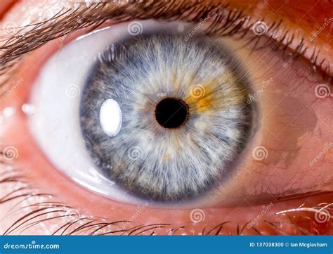 Close Up Eye. Close Up Iris. Very Close Macro Shot of an Eyeball. Blue with Fibres and Orange ...