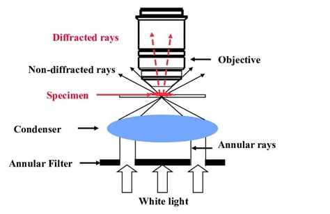 Dark-field Microscopy: Principle and Uses • Microbe Online