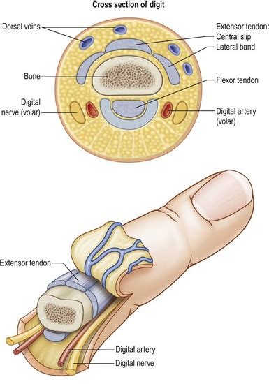 Replantation and revascularization | Plastic Surgery Key