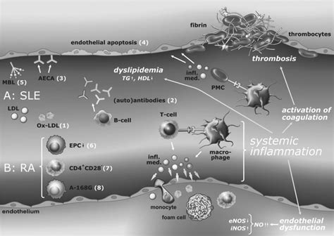 Schematic representation of the atherogenic effects of a systemic... | Download Scientific Diagram