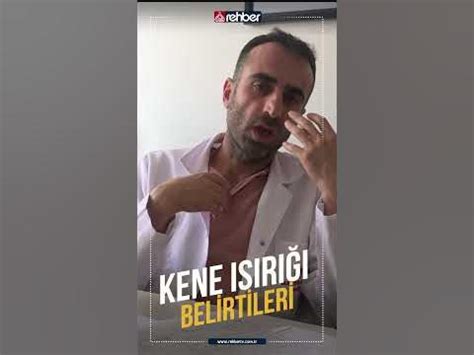 Kene ısırığı belirtileri | Enfeksiyon Hastalıkları Uzmanı Dr. Zeynel Abidin Demir - YouTube