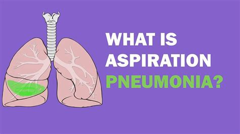 What is Aspiration Pneumonia?