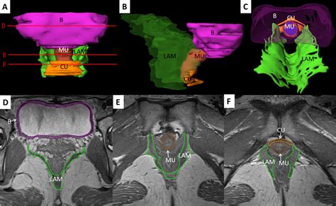 3D models and transverse MRI images of bladder detrusor and urinary... | Download Scientific Diagram