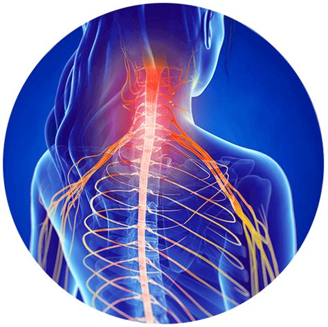 Pinched Nerve | Symptoms & Advanced Spine Care