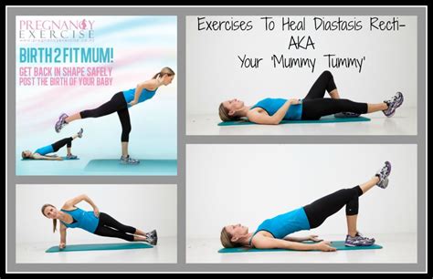 Diastasis Recti Exercises- Exercises to Heal Your 'Mummy Tummy ...