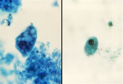 Public Domain Picture | This split-screen image revealed two parasitic ...