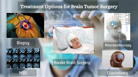 Brain Tumor Surgery | Types, Recovery & Risk Medsurge India