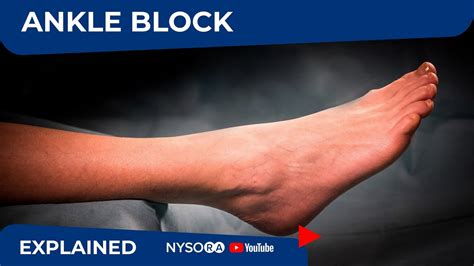 Ultrasound-Guided Ankle Block (Video) - NYSORA