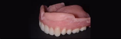 A Primer on Soft Denture Liners - Spear Education