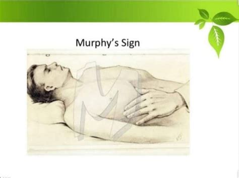 Important Facts About Murphy’s Sign – Platform | CME