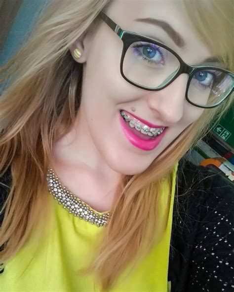 #braces #girlswithbraces #metalbraces #glasses #glassesandbr - DaftSex HD