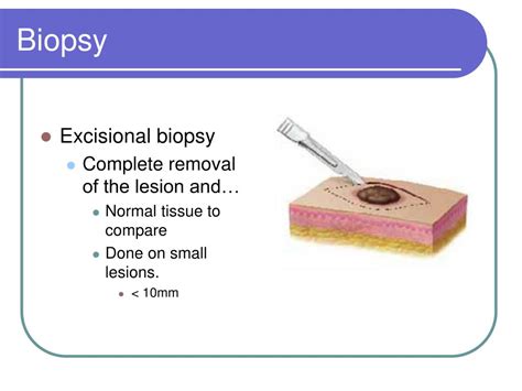 PPT - Chapter 25 Oral and Maxillofacial Surgery PowerPoint Presentation - ID:4517267