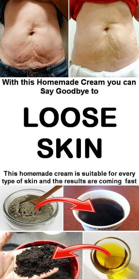 Homemade Cream for Loose Skin - Our Health Advice | Loose skin, Skin ...