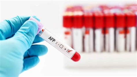 Alpha fetoprotein tumor marker & alpha fetoprotein screening test in ...