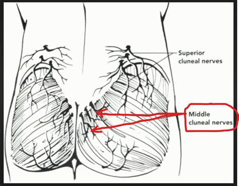 Coccyx Pain