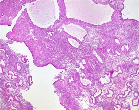 Download 20 Endometrium Uterus Histology Labeled