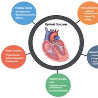 Managing Patients With Short-Term Mechanical Circulatory Support – Critical Care News | News for ...