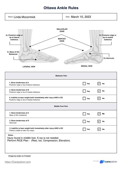 Ottawa Ankle Rules & Example | Free PDF Download