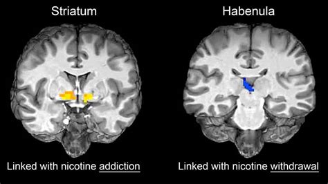 What Does Nicotine Do to the Brain? - Addict Advice