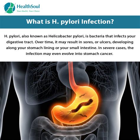 H. pylori Infection: Symptoms and Treatment | Gastroenterology | HealthSoul