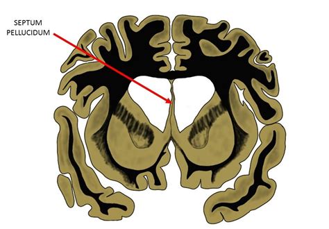 Septum pellucidum - definition — Neuroscientifically Challenged