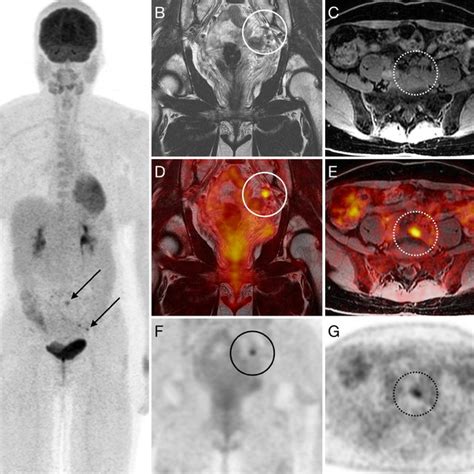 Overview of components of a rectal-cancer PET/MRI protocol. DWI and DCE ...