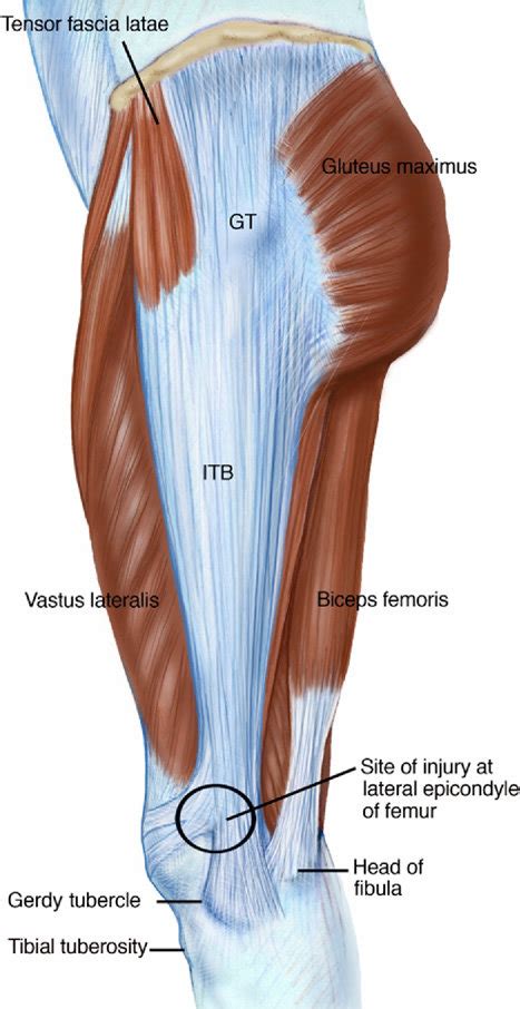 Epicondyle Mediale Femur : My Son Has A Swollen Knee Axis / The medial condyle is one of the two ...