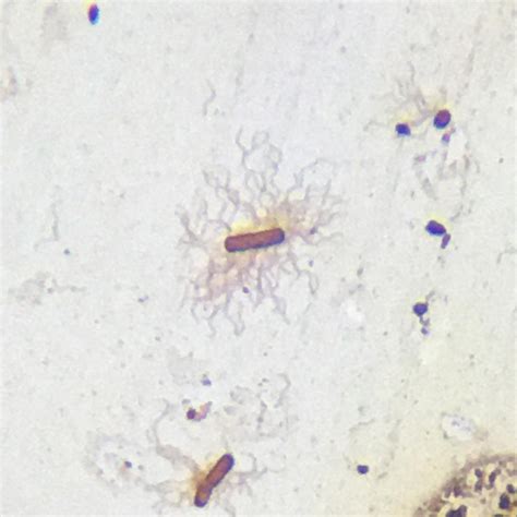 Salmonella typhi with flagella smear, silver stained, Microbiology ...