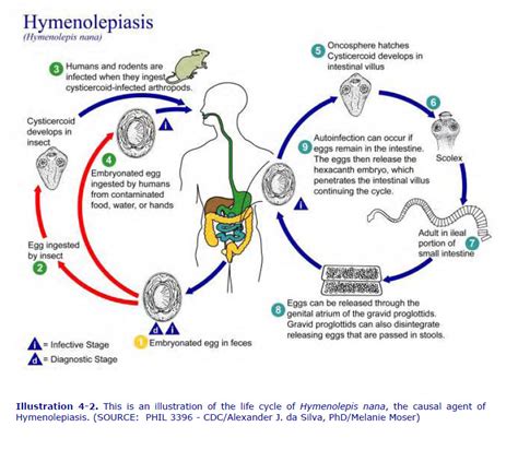 Hymenolepis Nana | Medical Laboratories