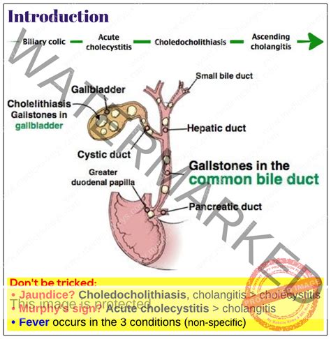 Introduction to biliary diseases - Medicine Keys for MRCPs