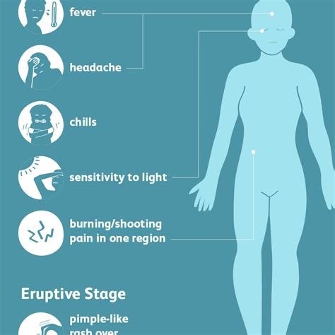 Shingles Symptoms