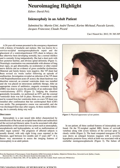 Iniencephaly in an Adult Patient | Canadian Journal of Neurological ...