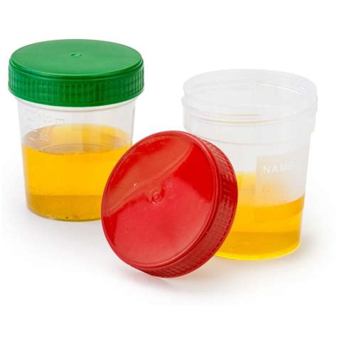 Urine Collection Cups for On-Site Collection & Testing - Producers of ...