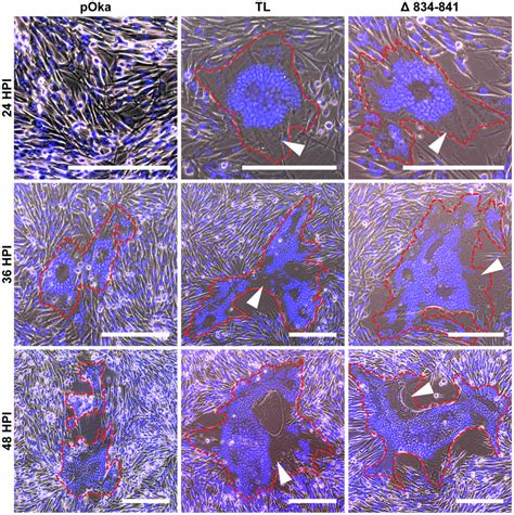 Truncation of the gHcyt causes exaggerated syncytia formation in ...