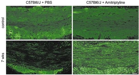 Anti-Myelin Basic Protein antibody (ab40390) | Abcam