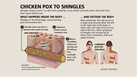 Chickenpox Rash