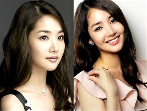 Park Min Young Before And After Photos