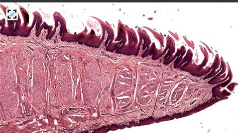 Histology of tongue filiform and fungiform papillae - YouTube