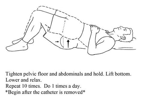 Post Prostatectomy Excercises - Urology San Antonio