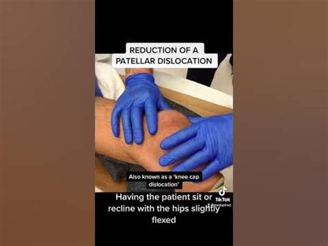 Reduction of a Patellar Dislocation - YouTube