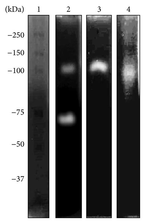 Zymography assay in 10% PAGE copolymerized with 0.1% (w/v) holo-hLf ...