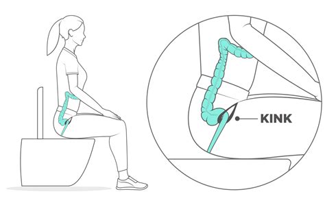 √ Squatty Potty Diagram