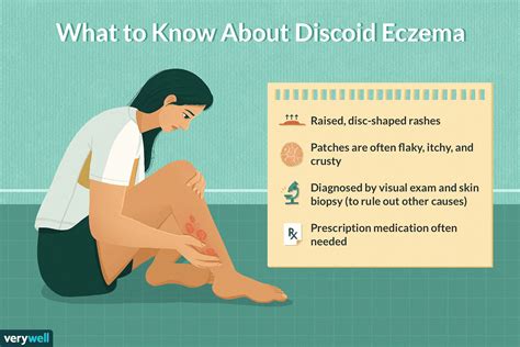 ภาพรวมของ Discoid Eczema - MedThai