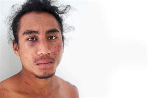 Samoa Observer | Alleged Police brutality