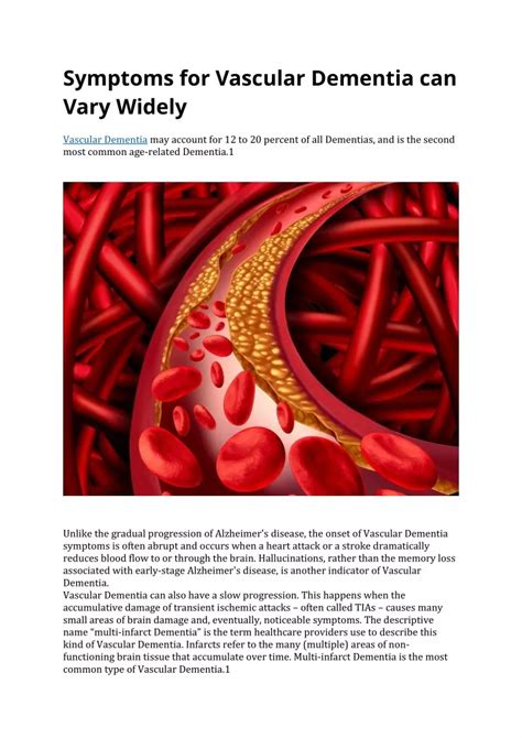 PPT - Symptoms for Vascular Dementia can Vary Widely PowerPoint ...