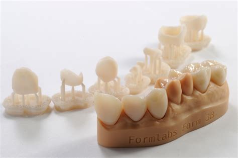 Digital Dentistry and dental resin 3D-printing | Liqcreate