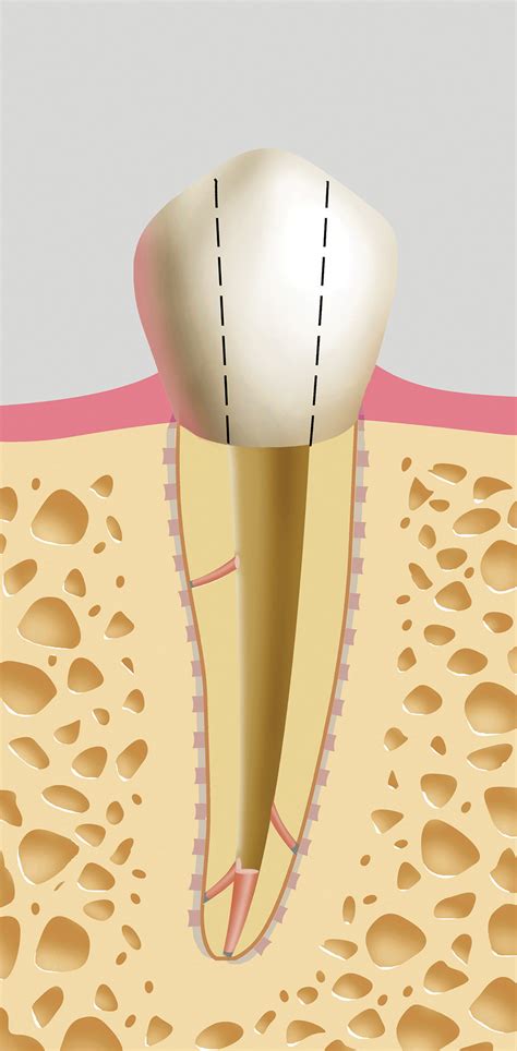 Glassman-Fig-#11 - Oral Health Group