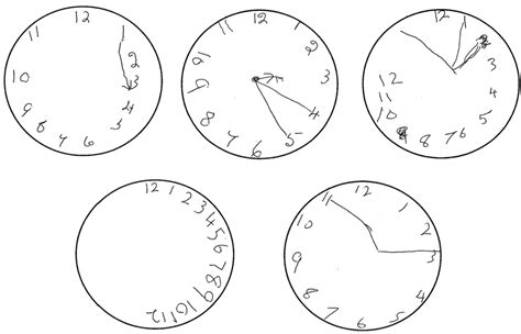 [PDF] Automatic interpretation of clock drawings for computerised assessment of dementia ...