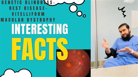 Vitelliform Macular Dystrophy(Best Disease)-genetic blindness and it’s treatment/management ...